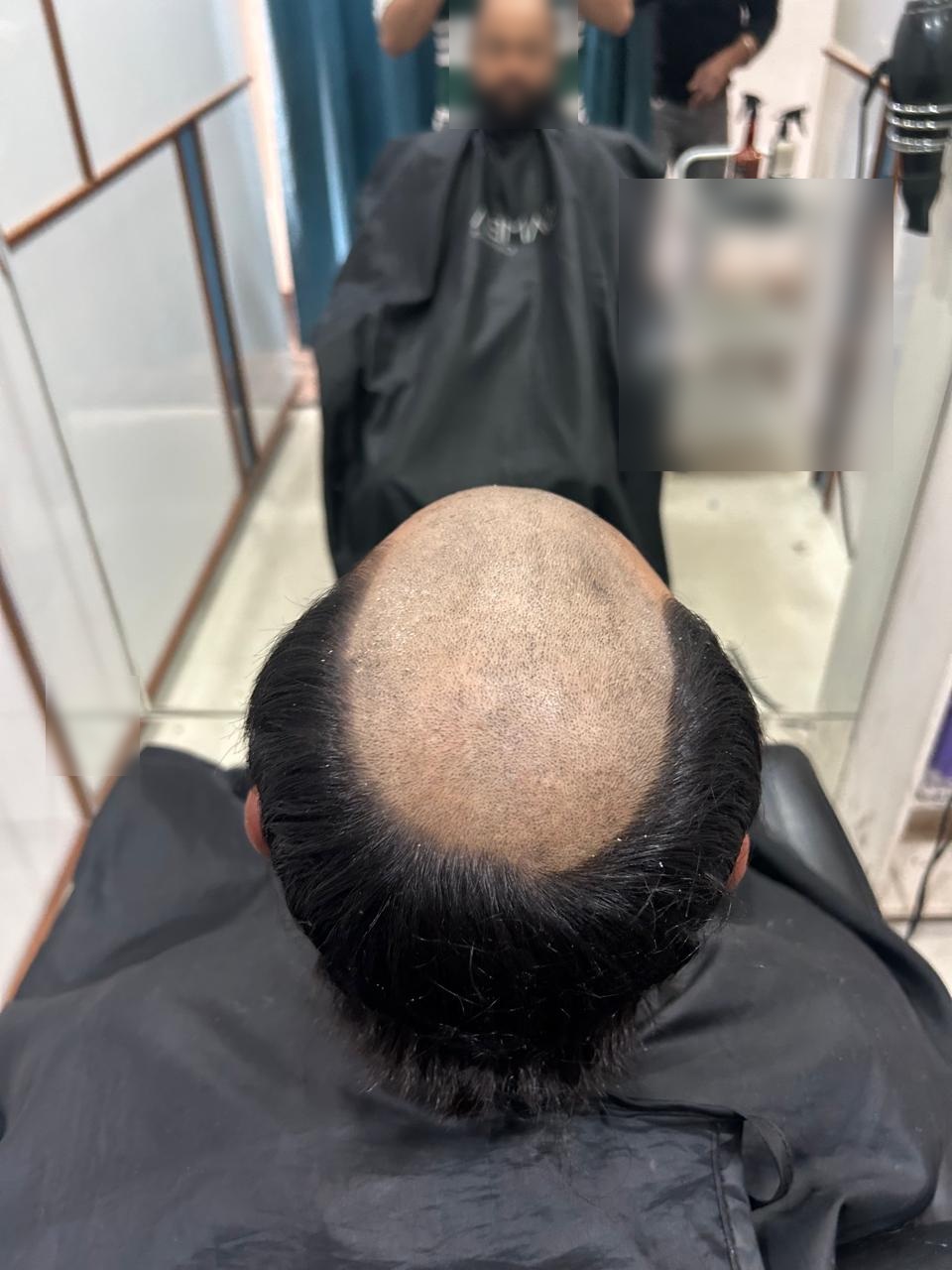 Hair Bonding for Men
